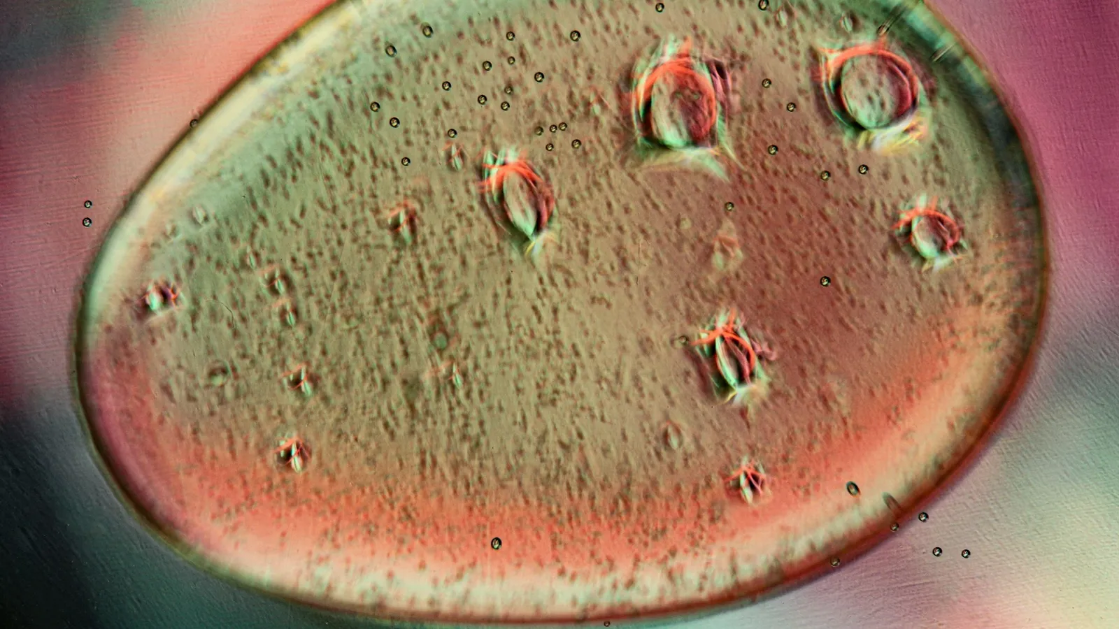 A bacterial culture seen up close under a microscope