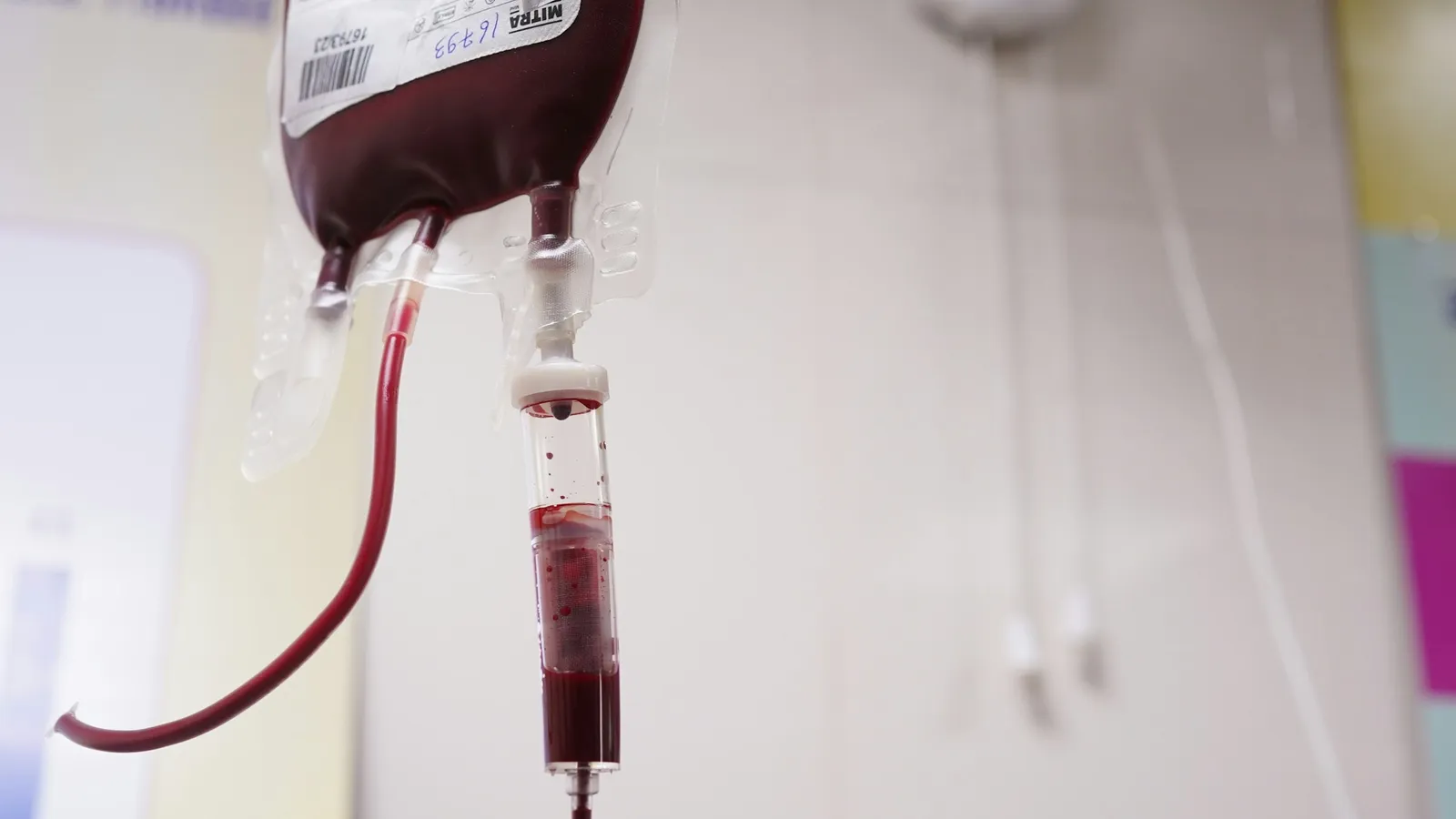 A bag of donated blood hanging from a stand