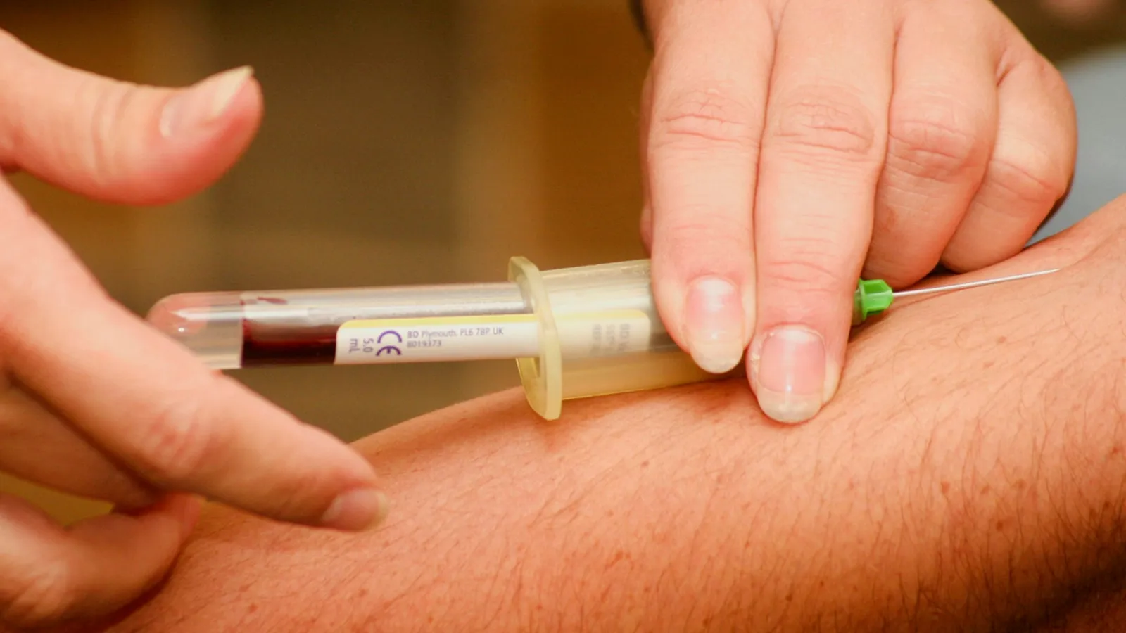 A blood sample being drawn from an arm