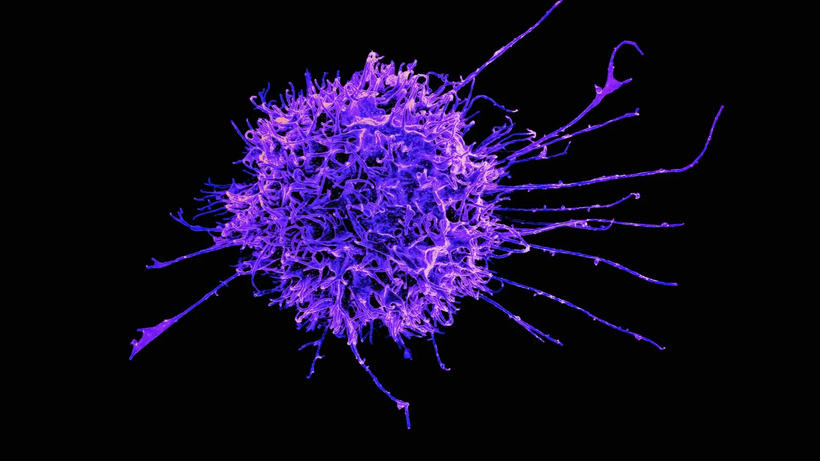 A coloured microscope image of a single cell with long projections