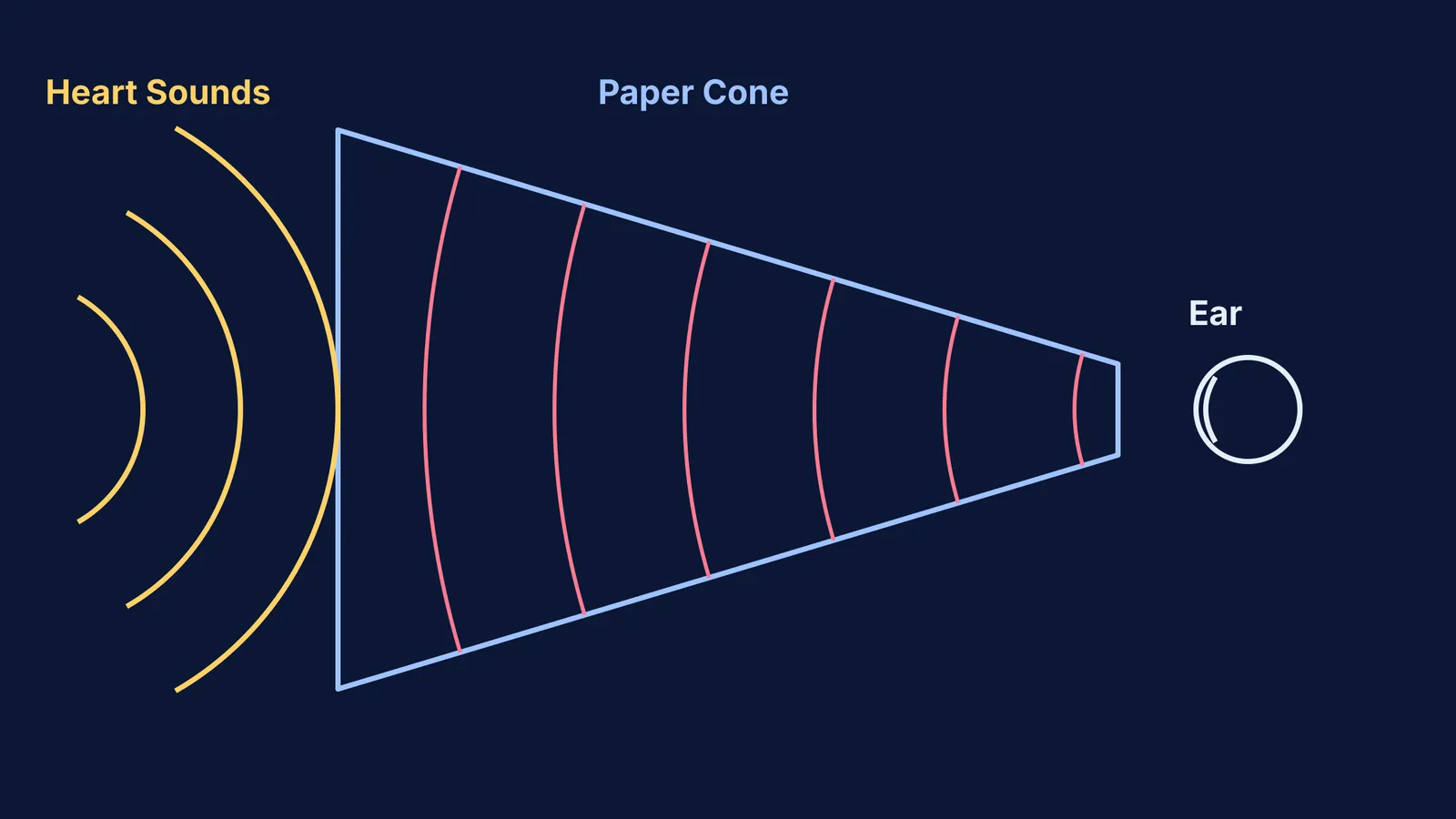 A diagram showing sound wavefronts concentrating inside a narrowing paper cone stethoscope.