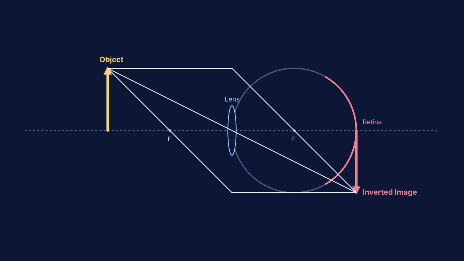 A geometrical ray diagram of a convex lens forming an inverted image on the retina