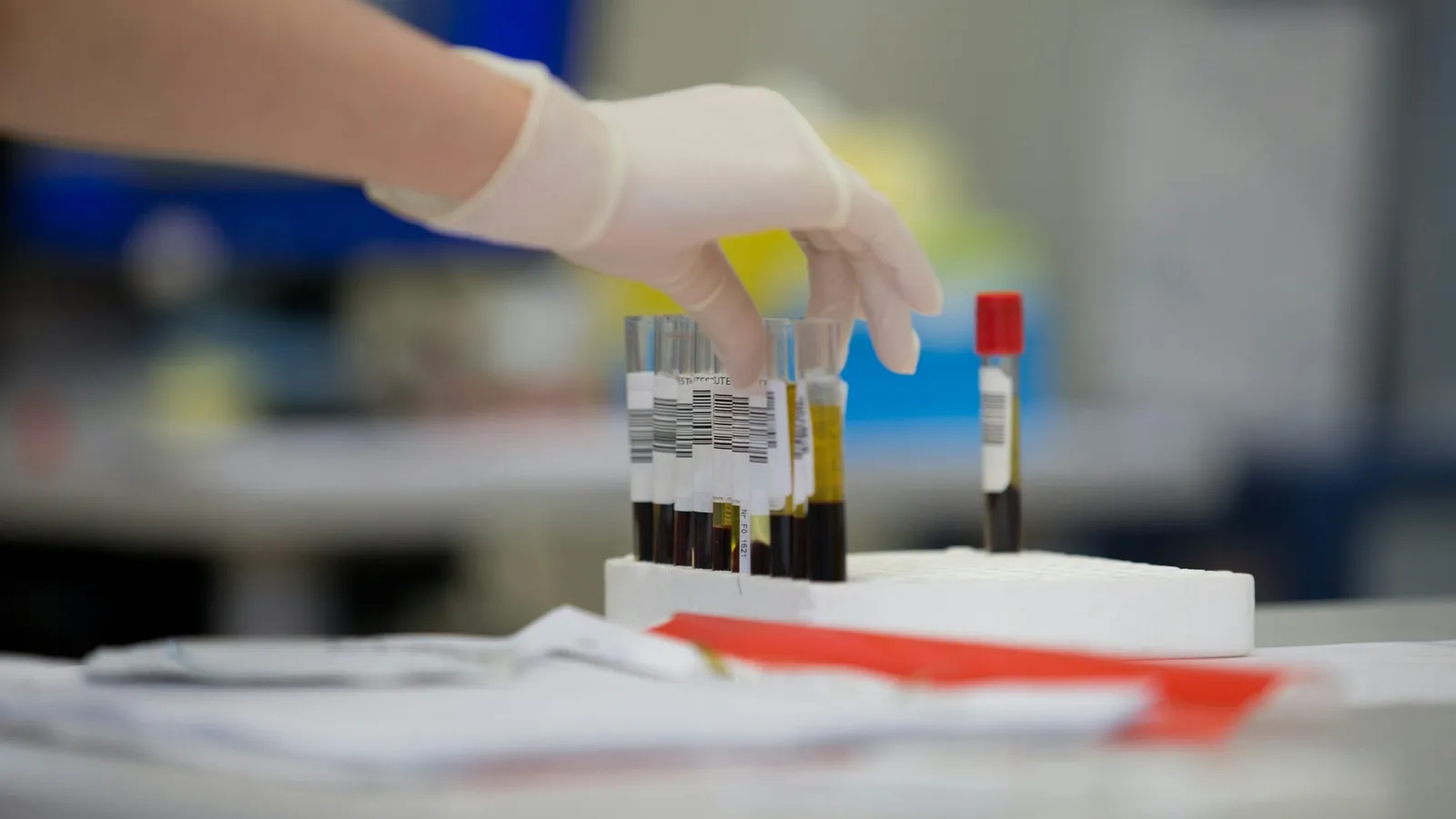 A gloved hand handling samples on a lab bench