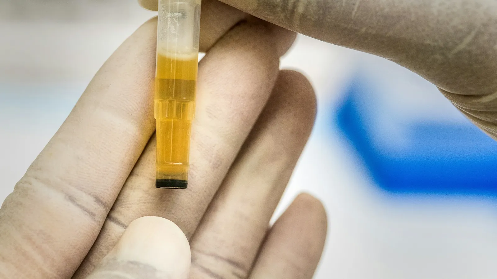 A gloved hand holding a sample tube of yellow liquid