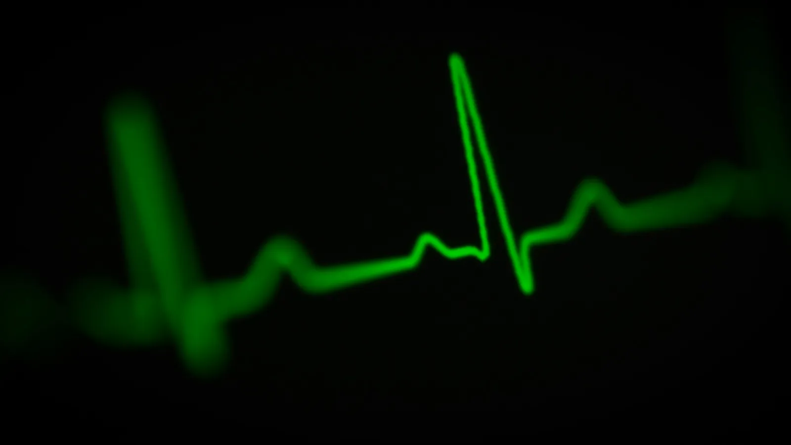 A green heartbeat trace on a dark monitor screen