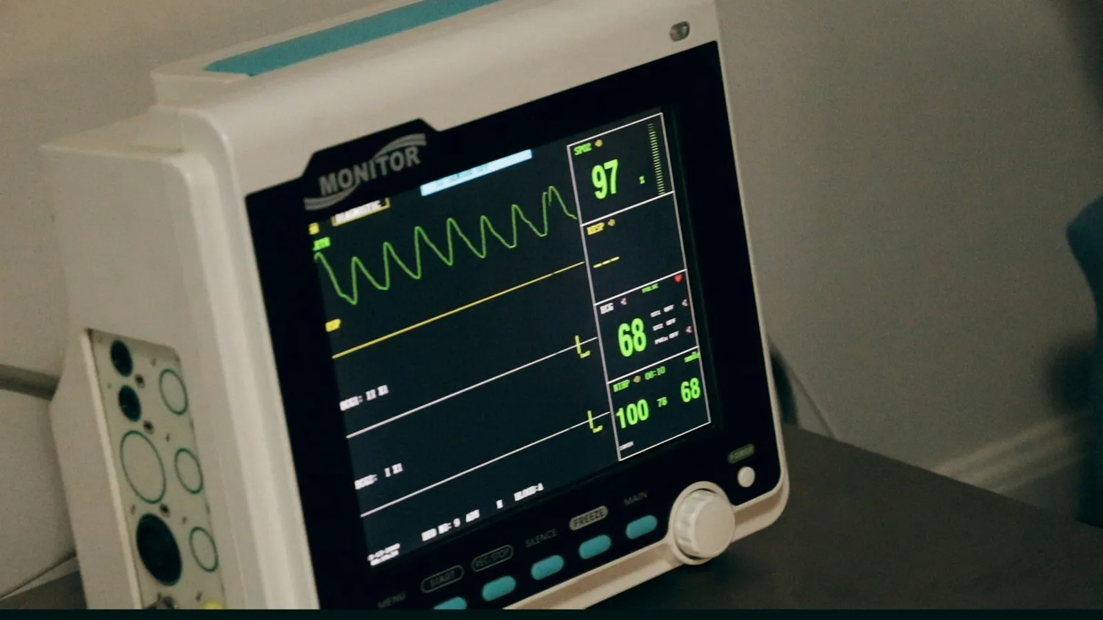A heart monitor showing an ECG trace