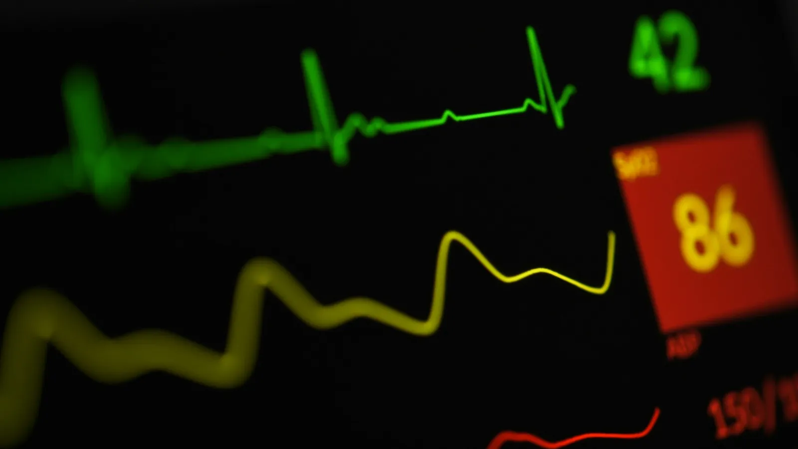 A heart-rate trace glowing on a monitor