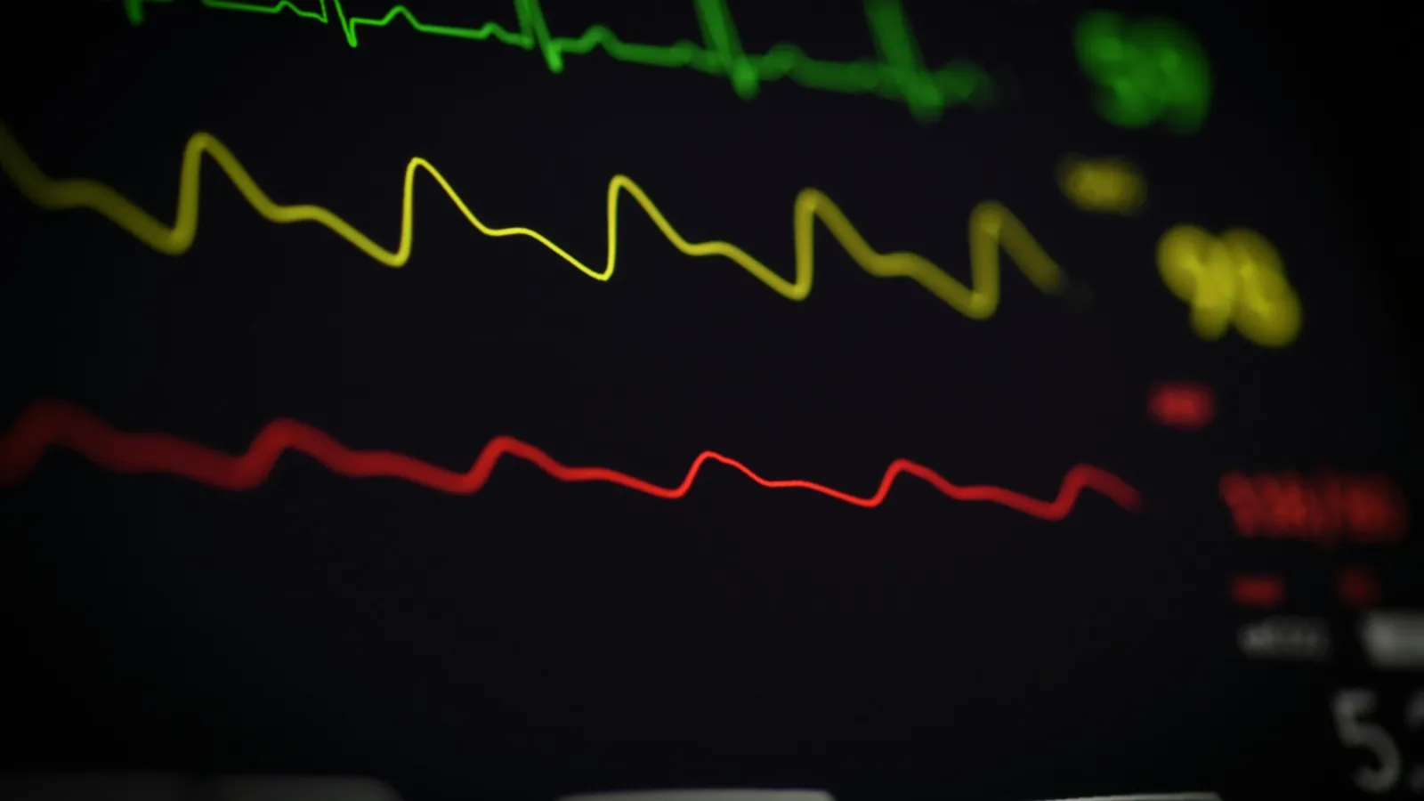 A heart-rate trace on a monitor screen
