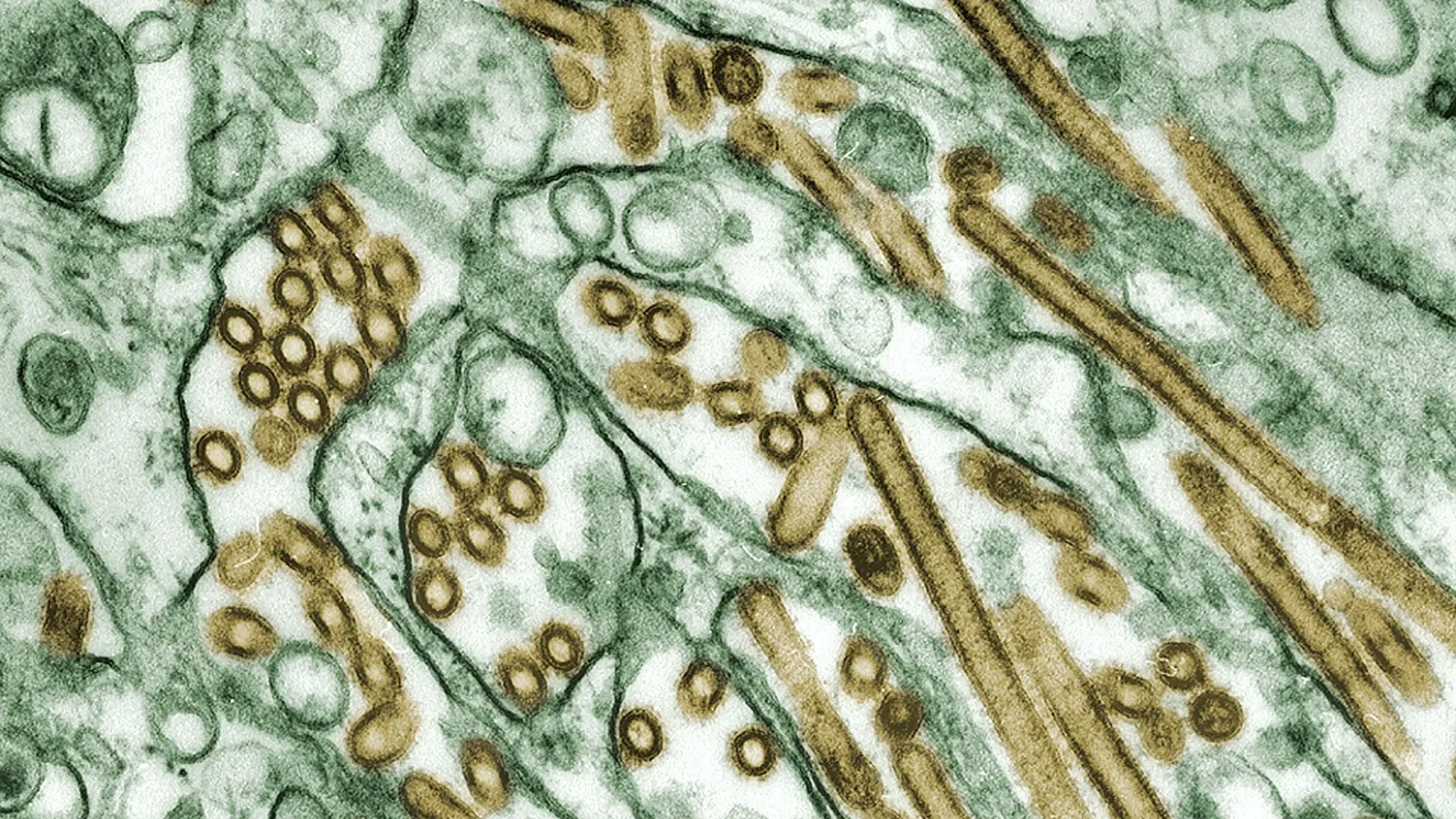 A microscope image of cell structures with many small organelles