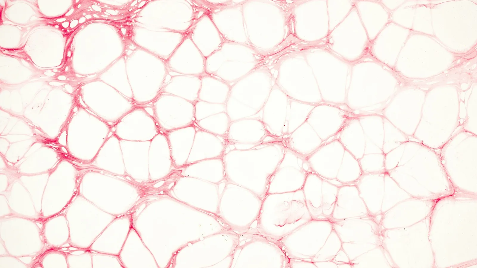 A network of cell walls seen under a microscope