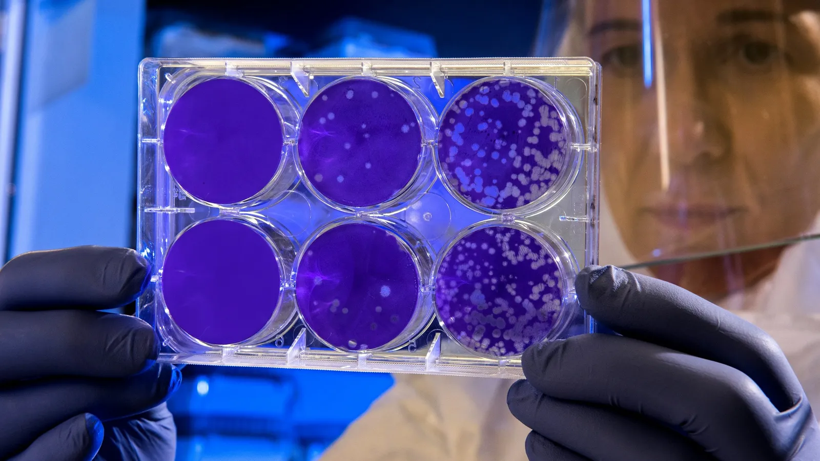 A scientist holding a cell culture plate with purple wells