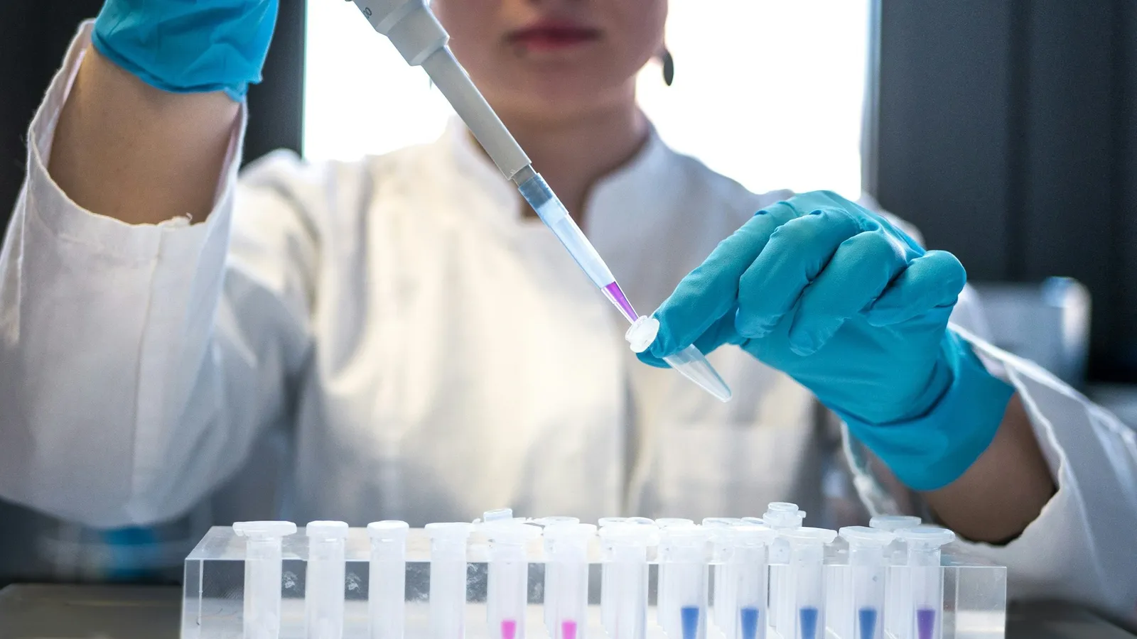 A scientist pipetting samples into a row of small tubes