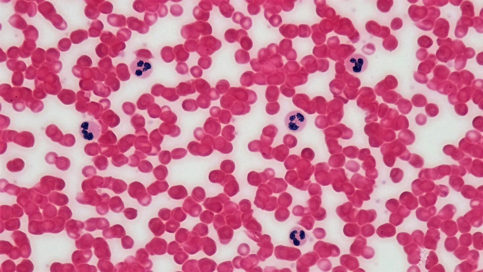 A stained blood smear seen under a microscope