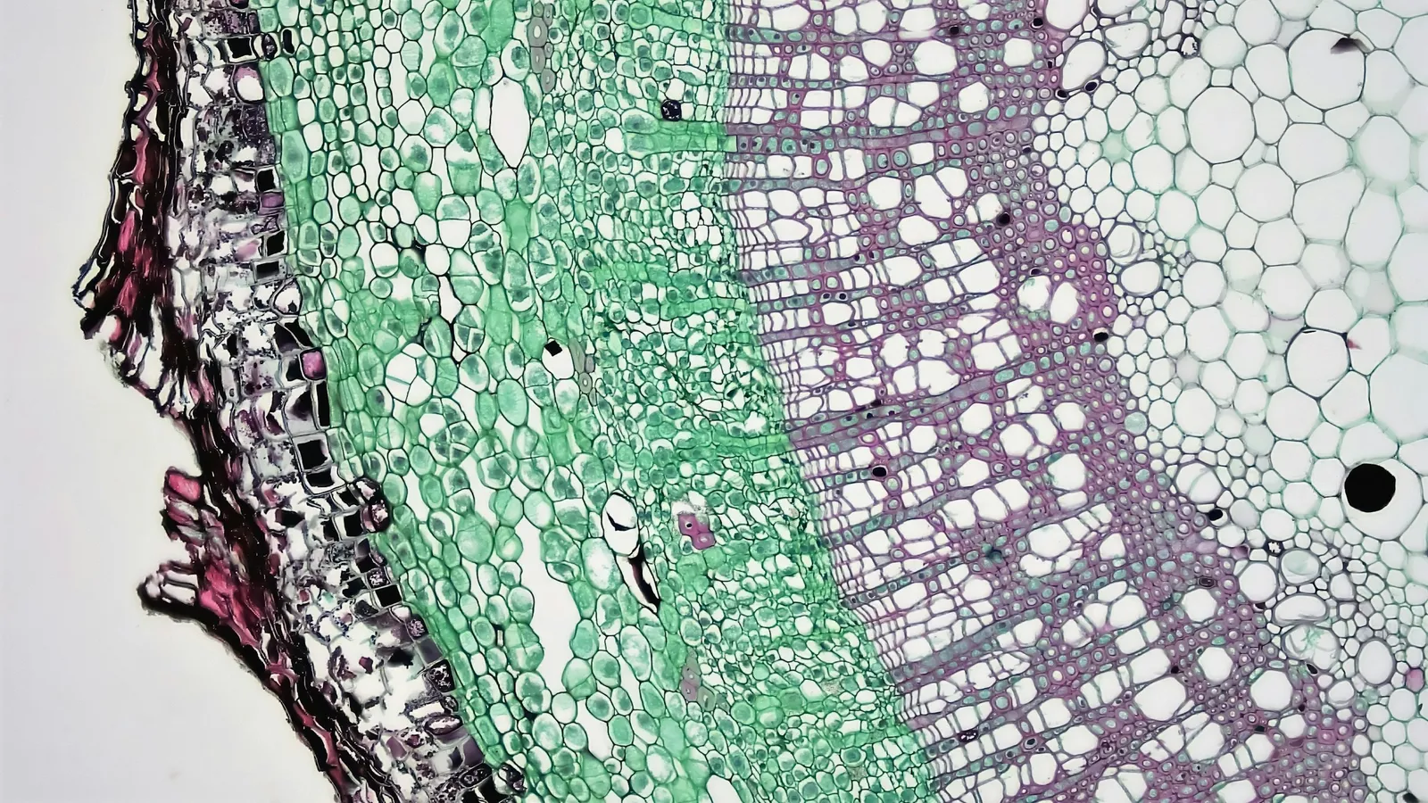 A stained cross-section of plant stem tissue under a microscope