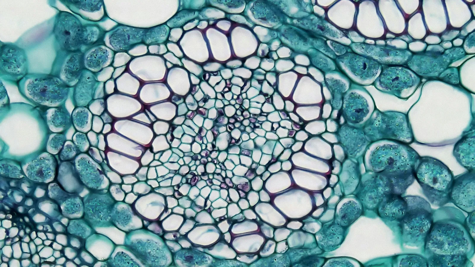 A stained cross-section of plant tissue seen under a microscope