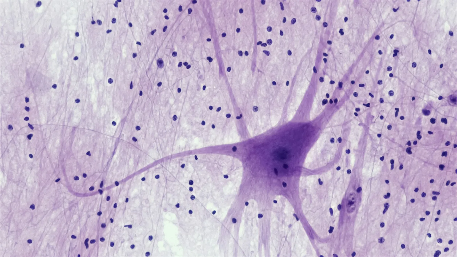 A stained nerve cell with branching processes seen under a microscope