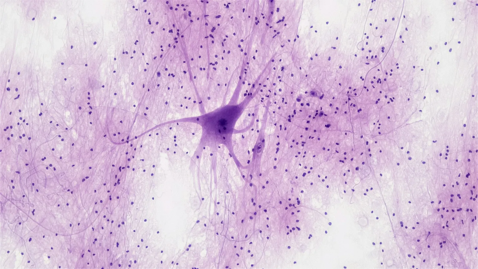 A stained neuron surrounded by small dark glial cell nuclei under a microscope