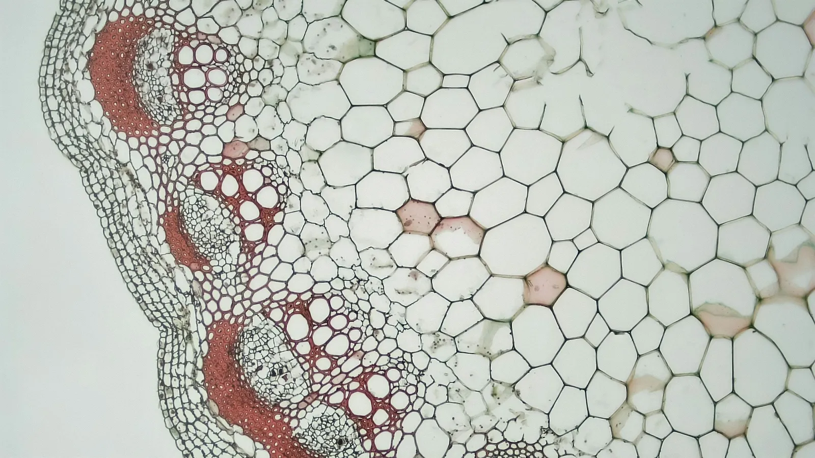 A stained plant tissue section showing many rounded cells
