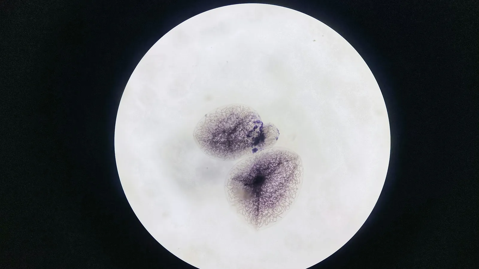 A stained sample seen in the round field of a microscope
