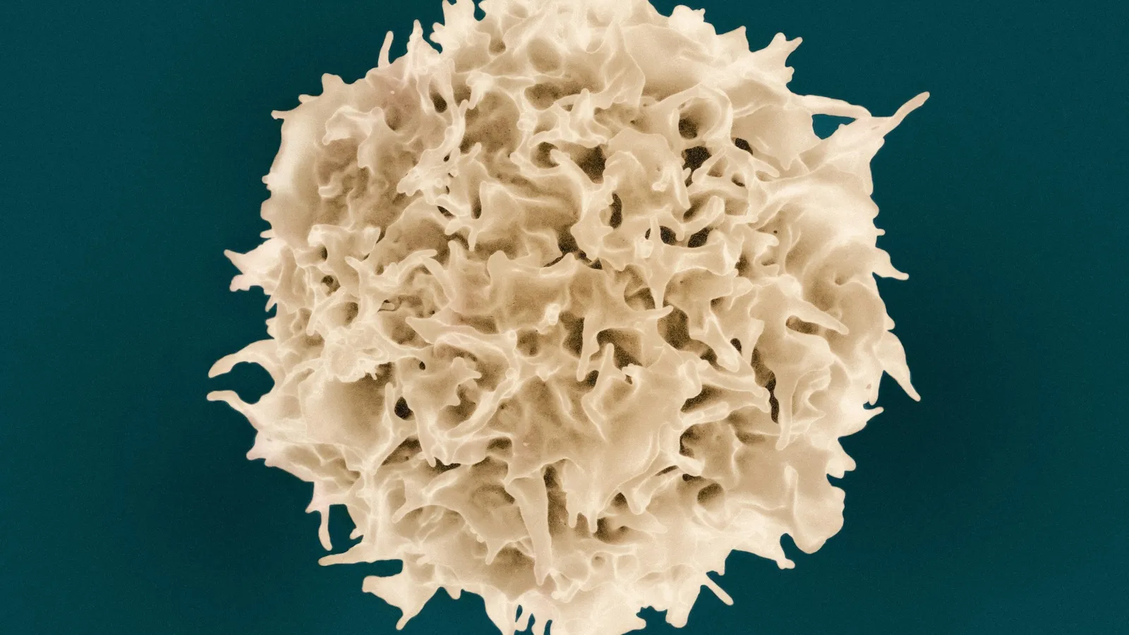 An electron microscope image of a single white blood cell