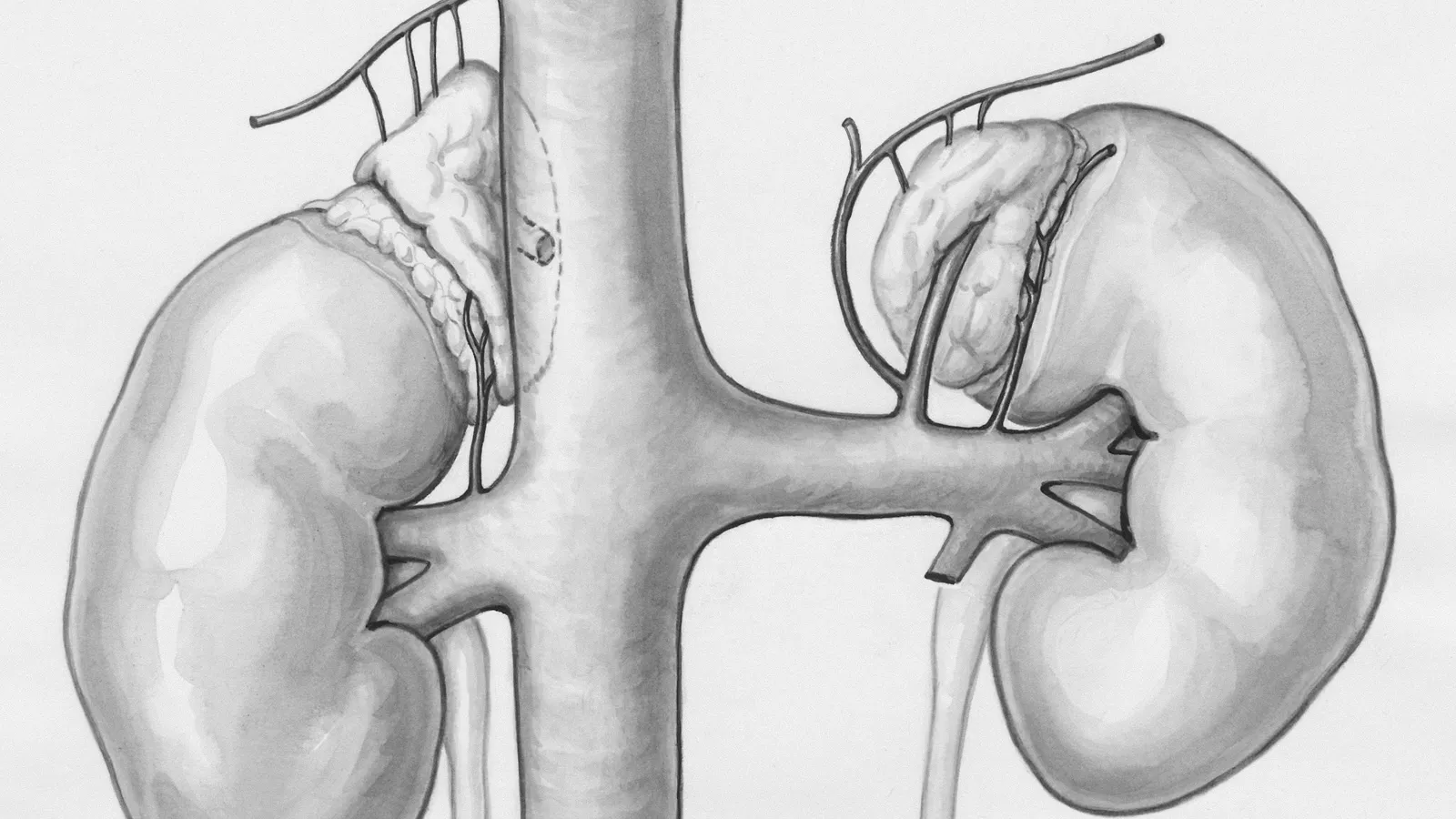 An old engraving of the kidneys and their blood vessels