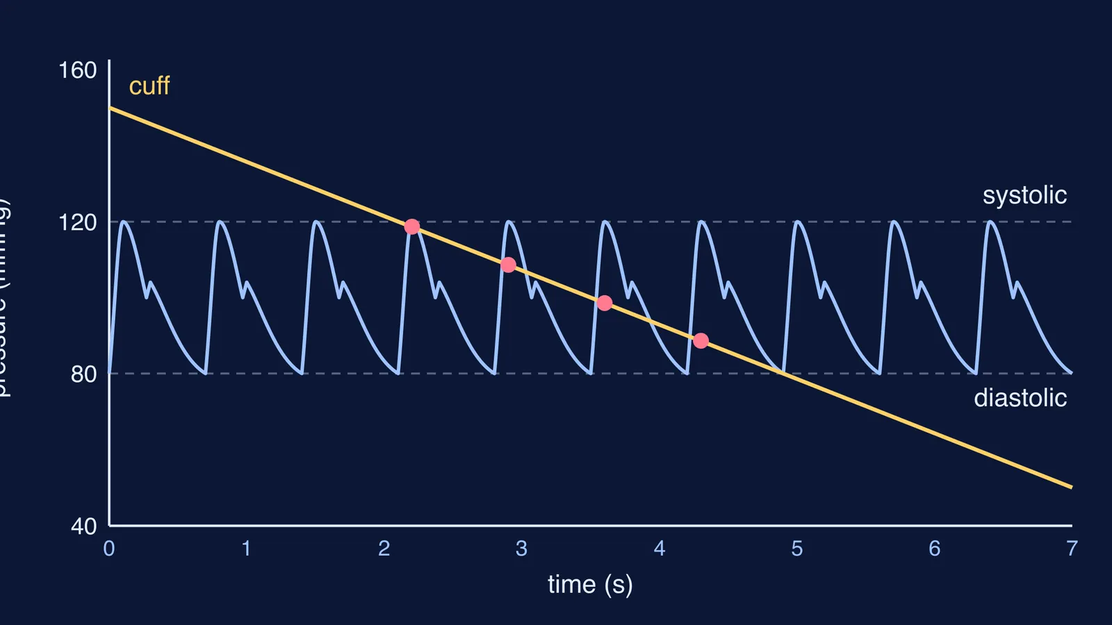 Arterial pressure wave between 80 and 120 mmHg with a falling cuff-pressure line
