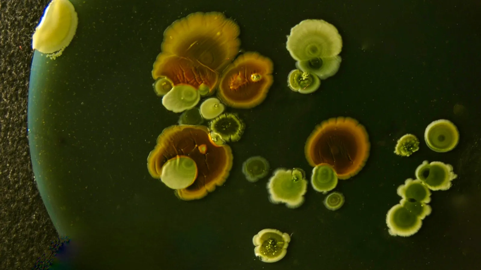 Bacterial colonies of different colours growing on a culture plate