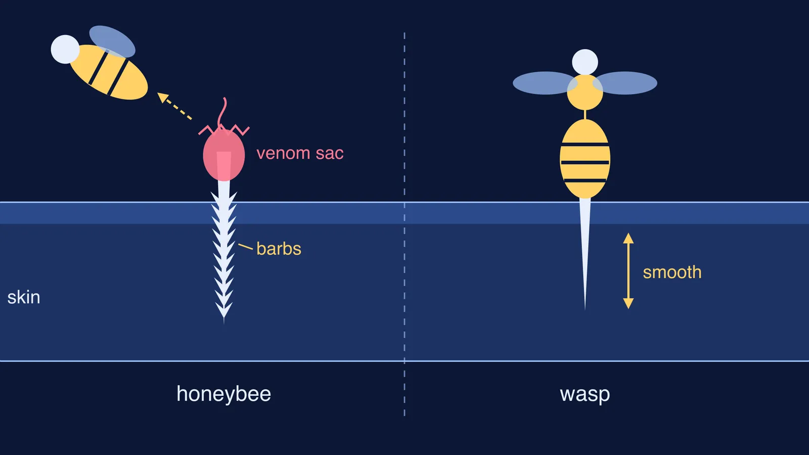 Barbed honeybee sting left in skin beside a smooth wasp sting
