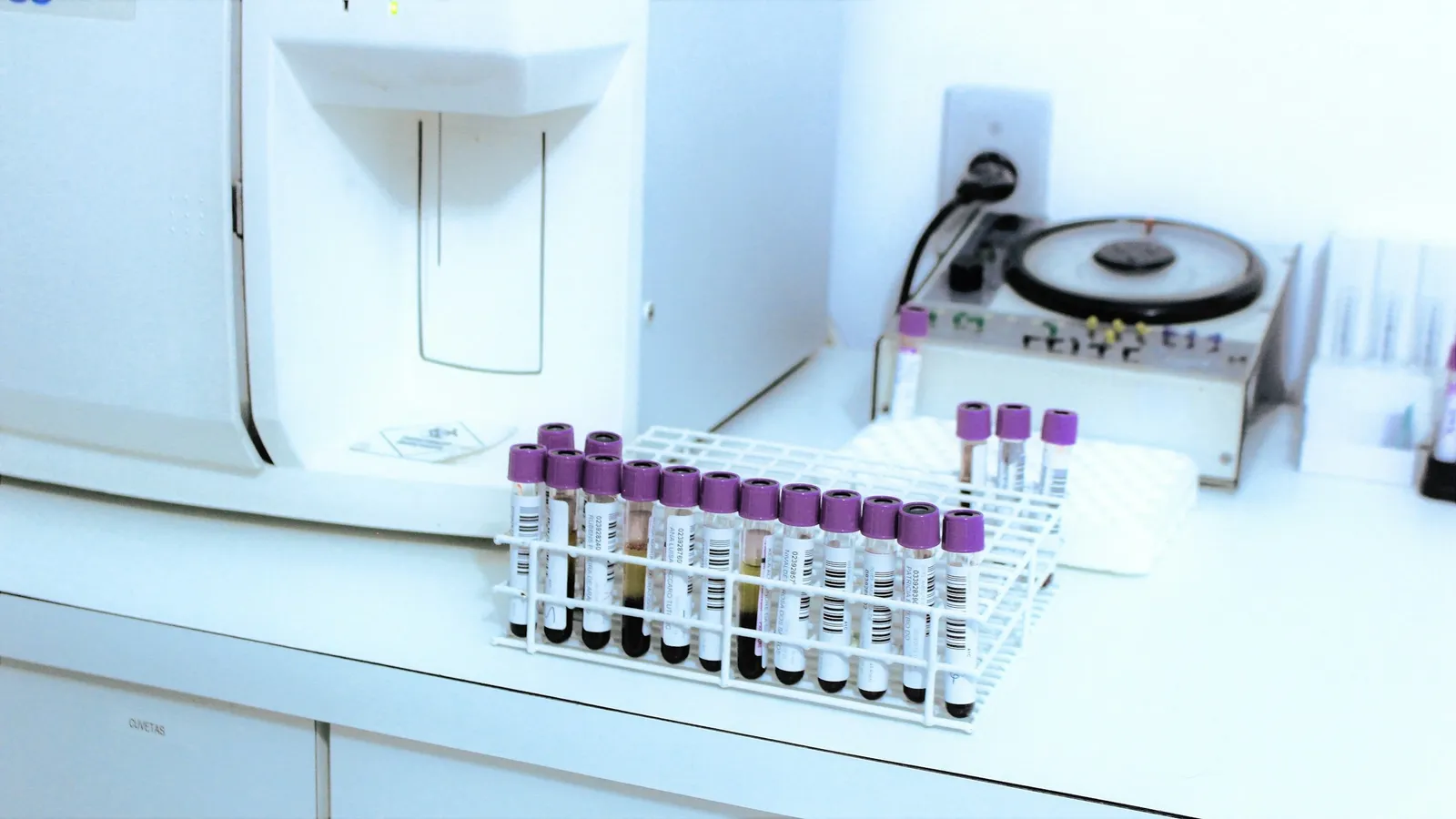 Blood sample tubes in a rack beside a laboratory analyser