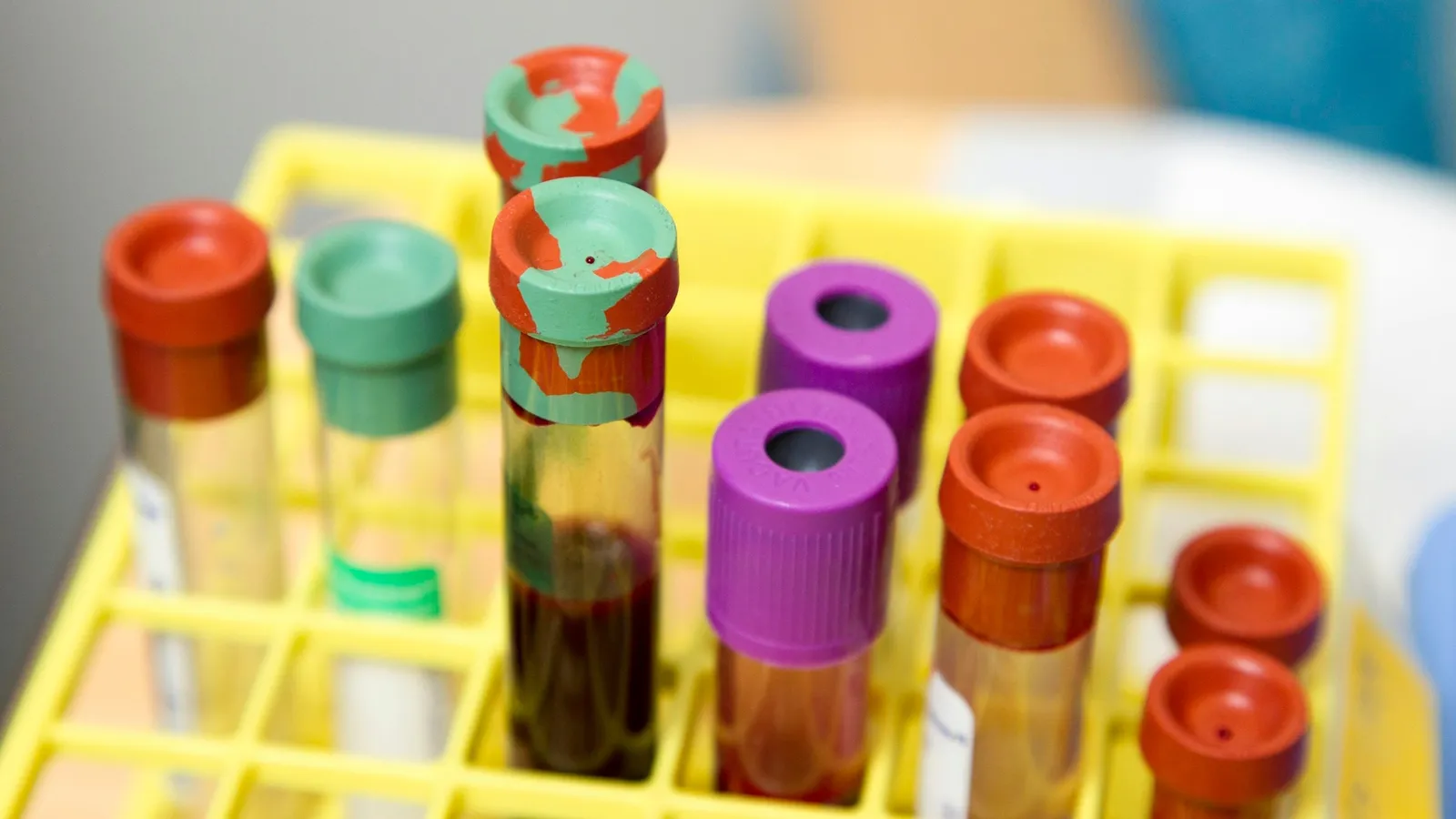Blood sample tubes with coloured caps in a rack