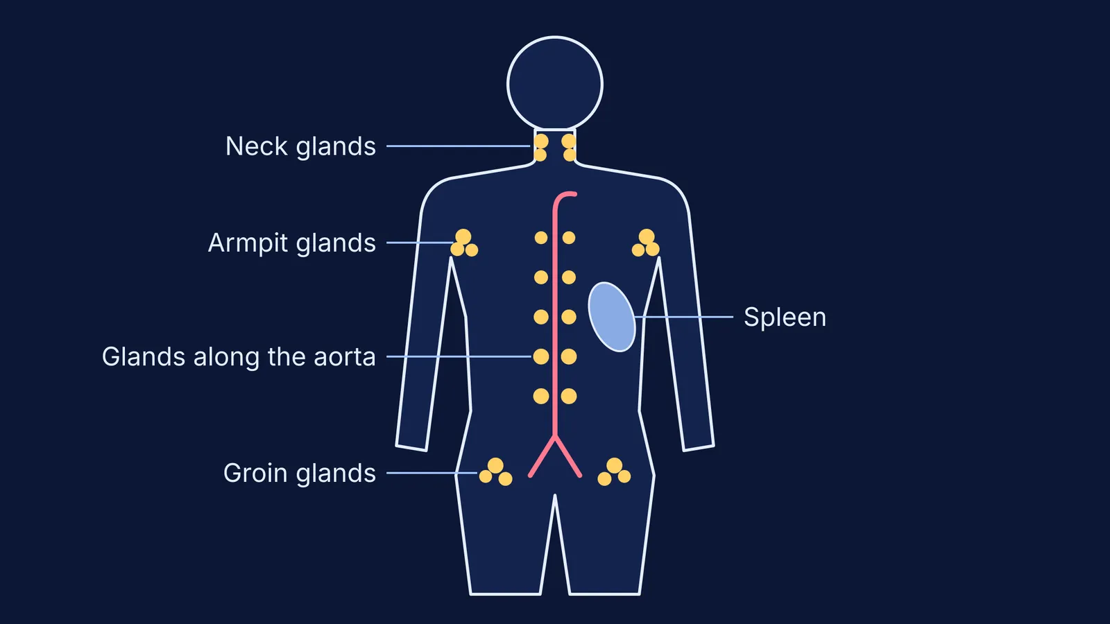 Body outline marking the lymph node sites and spleen Hodgkin described in 1832
