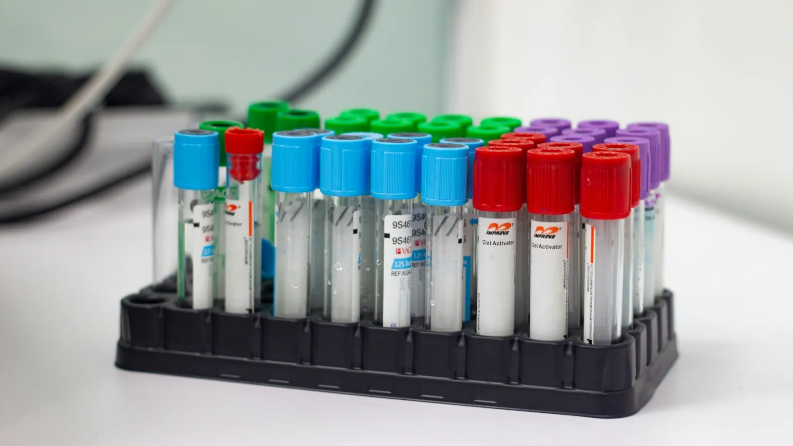 Capped sample tubes standing in a black rack