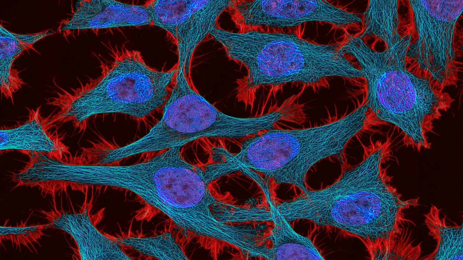 Cells with stained nuclei seen under a microscope