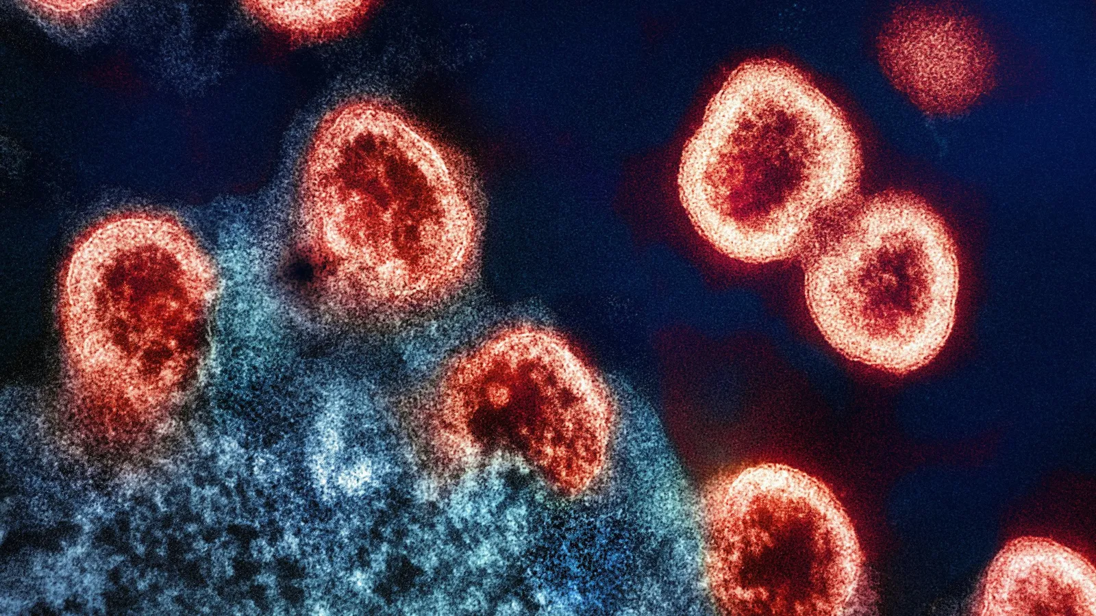 Coloured virus particles seen under an electron microscope