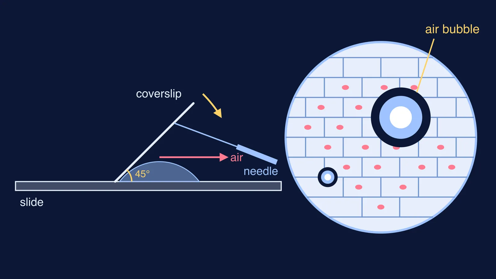 Coverslip lowered at 45 degrees on a needle, and bubbles among stained cells