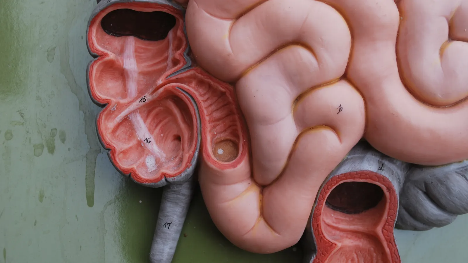 Cut-open anatomy model of the caecum with the narrow appendix hanging below