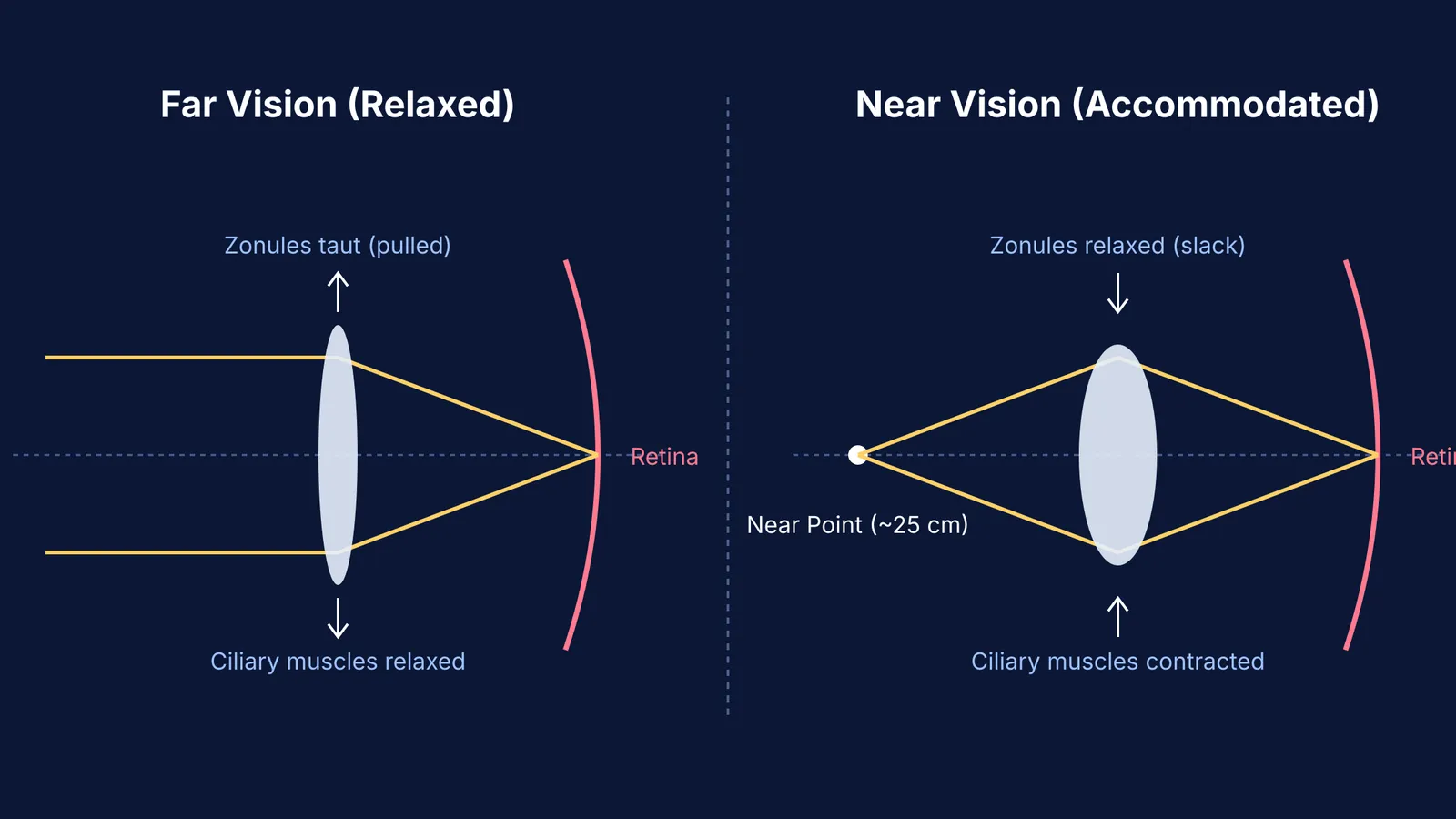 Diagram comparing far and near focus of the eye lens