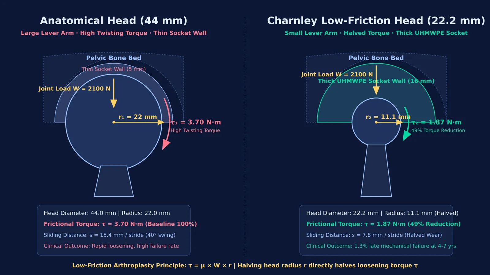 Diagram comparing frictional torque and socket thickness between anatomical and Charnley hip prostheses