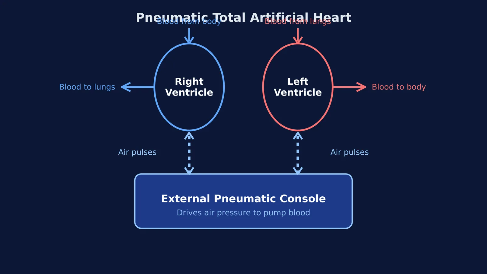 Diagram of a pneumatic total artificial heart with external console