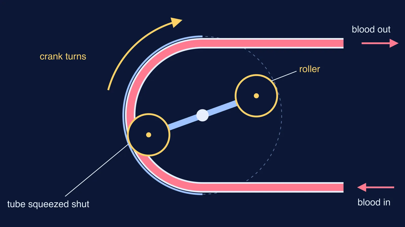 Diagram of a two-roller pump squeezing a blood-filled tube against a curved track