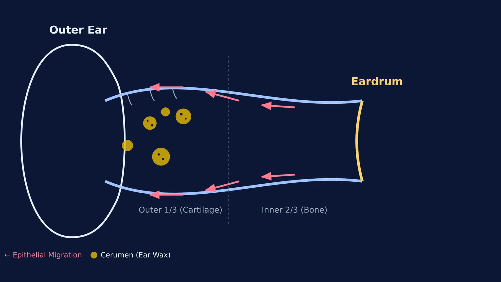 Diagram of an ear canal showing skin cells pushing cerumen outwards