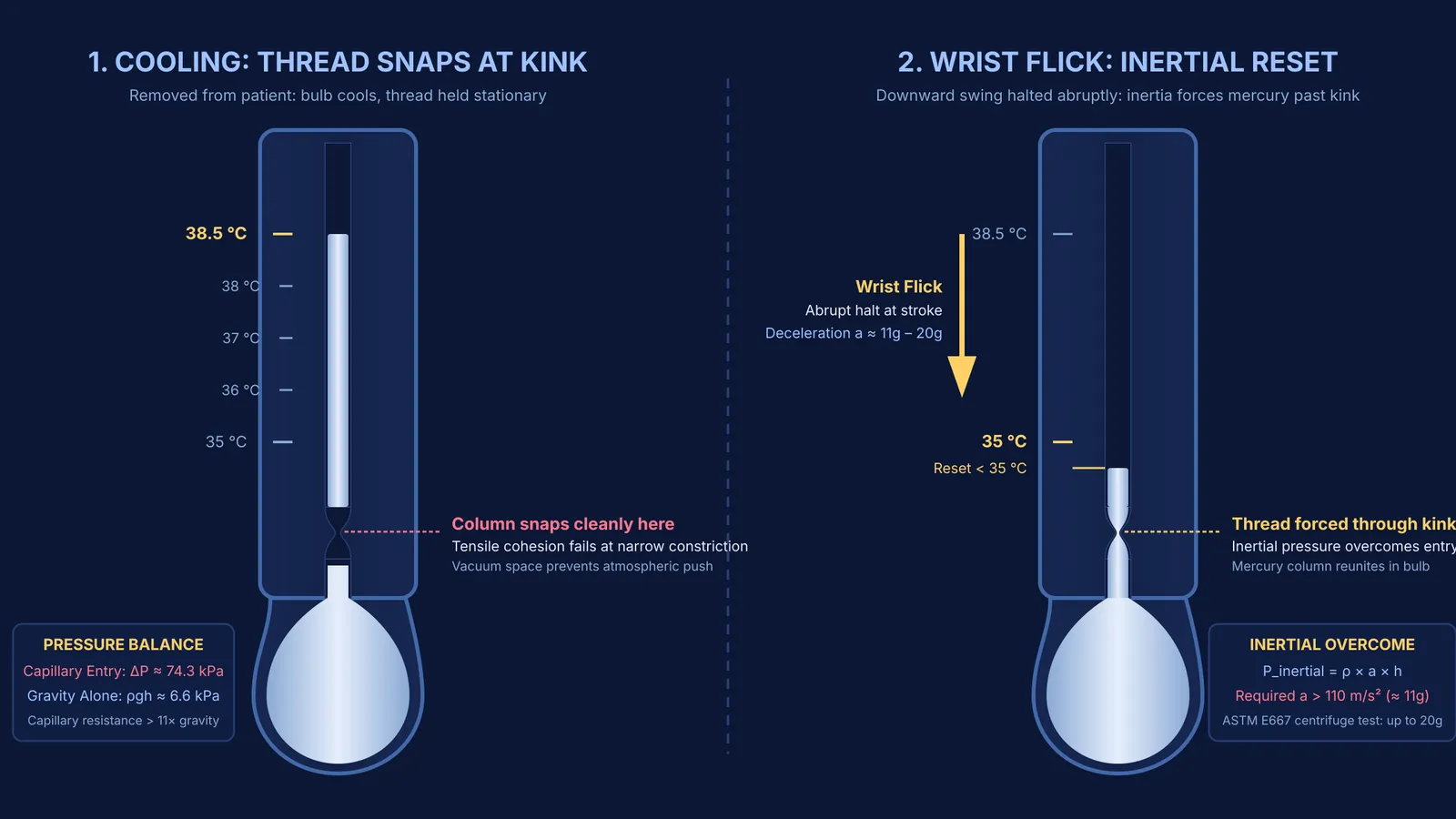 Diagram of clinical thermometer constriction showing thread separation on cooling and reset under inertia