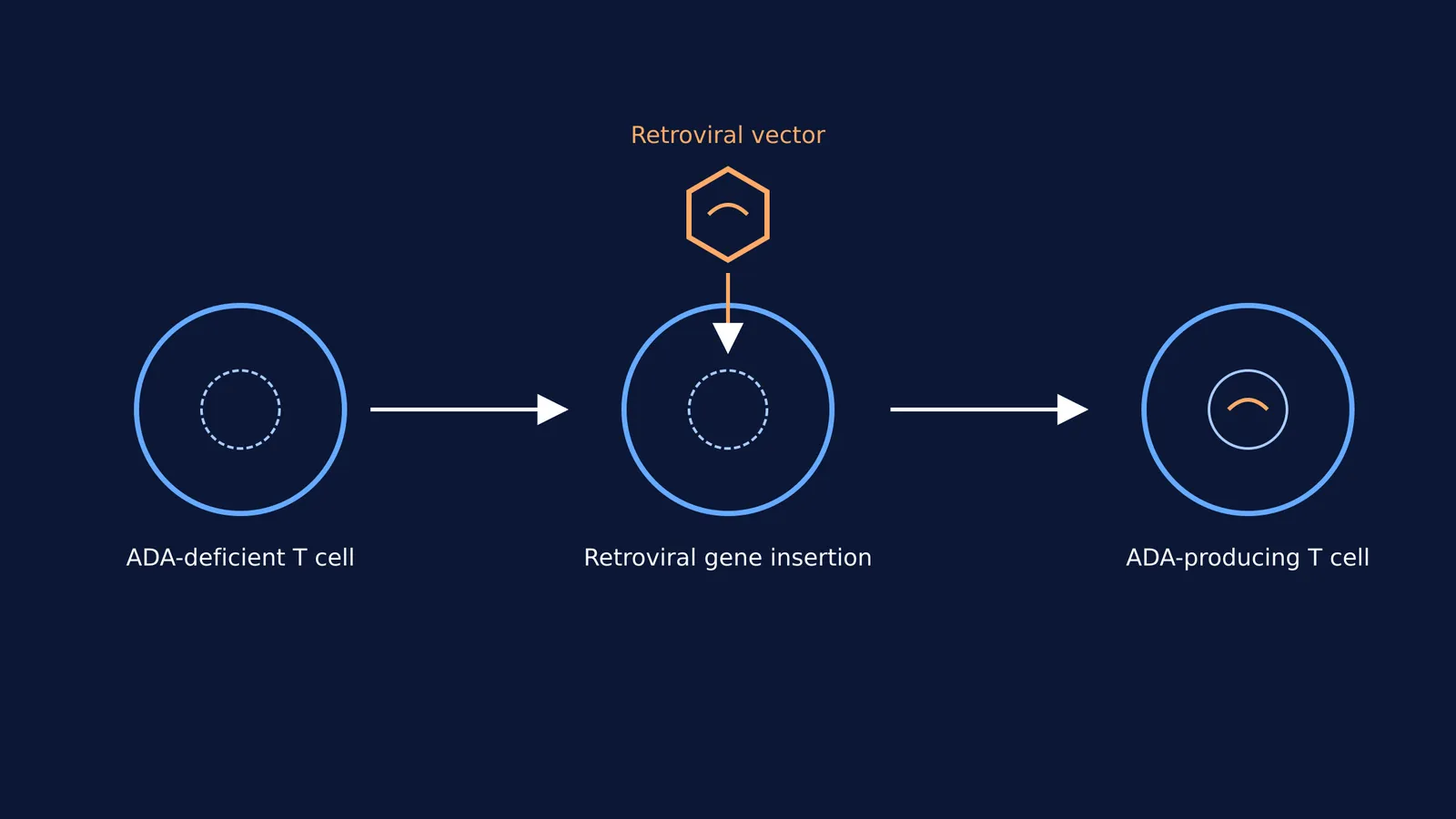 Diagram of ex vivo gene therapy for ADA-deficient T cells