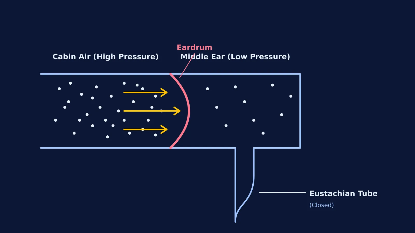 Diagram of high-pressure cabin air pushing the eardrum inward with a closed Eustachian tube.