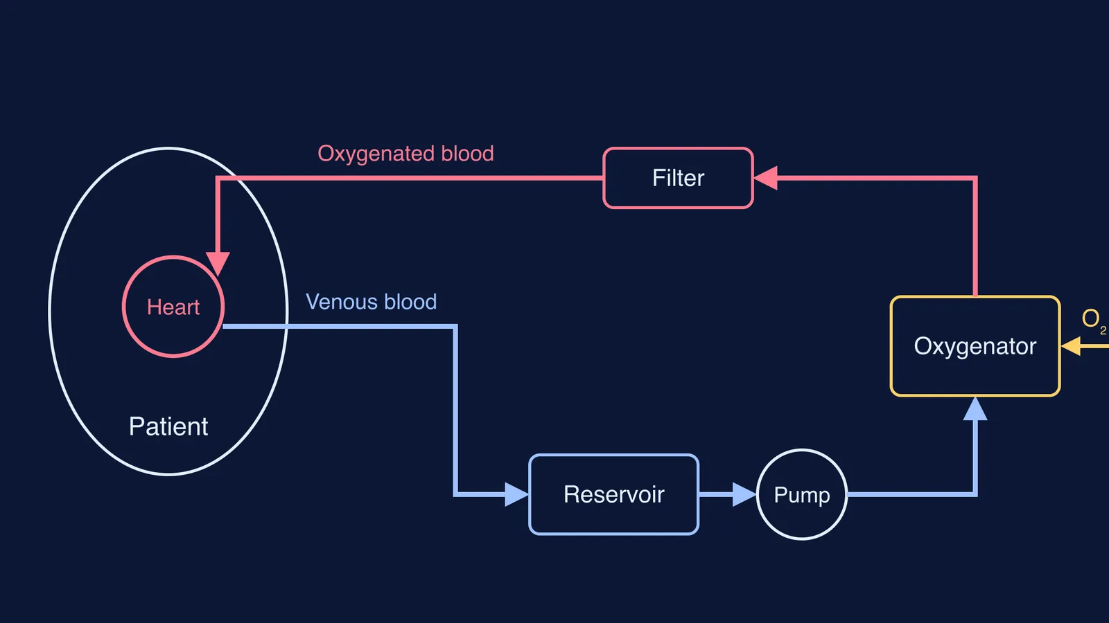 Diagram of the heart-lung machine circuit a perfusionist runs during heart surgery
