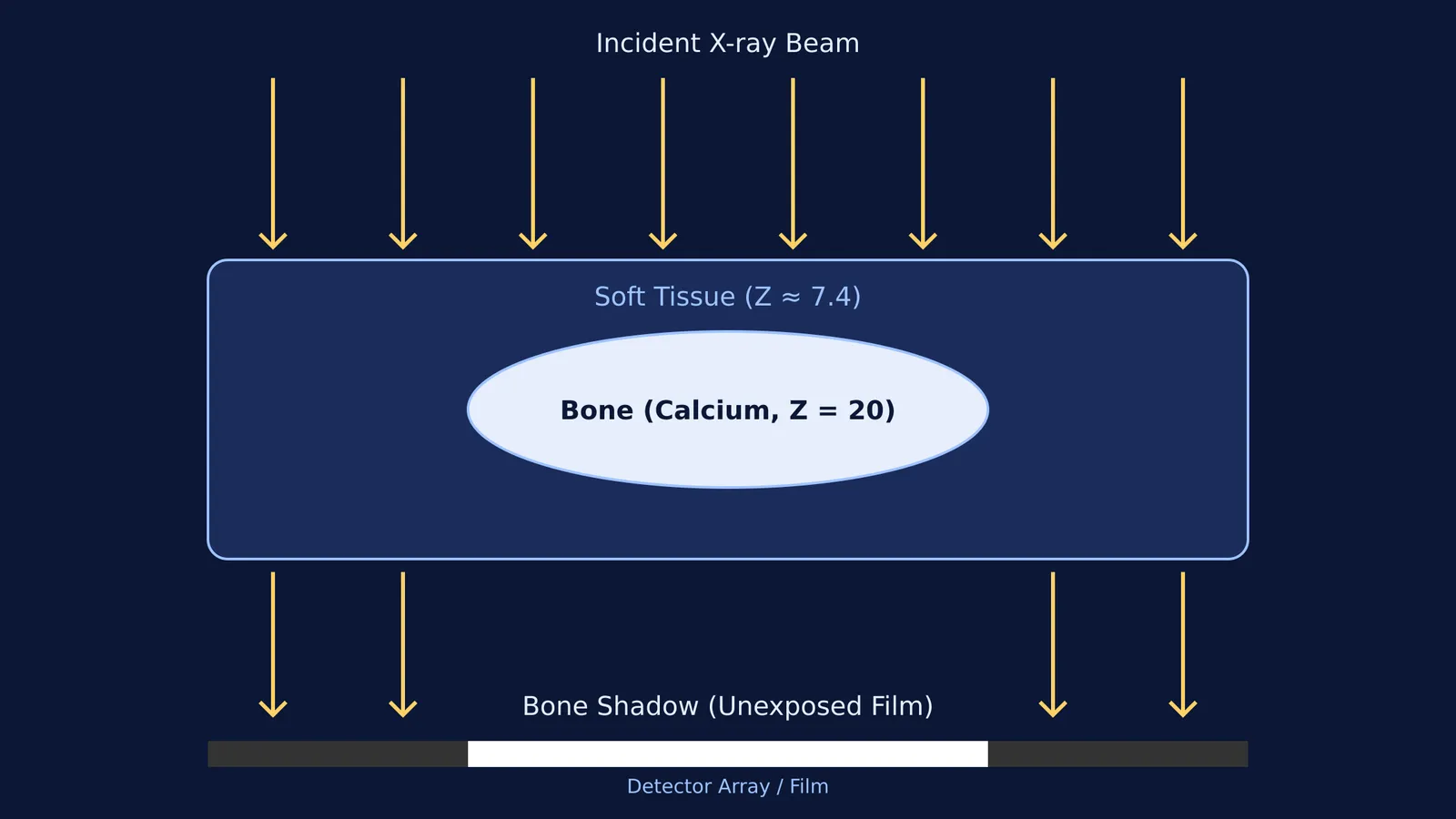 Diagram of X-ray beam showing high absorption in bone versus soft tissue