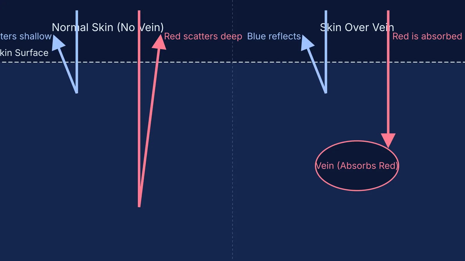 Diagram showing how blue light scatters and red light is absorbed by veins