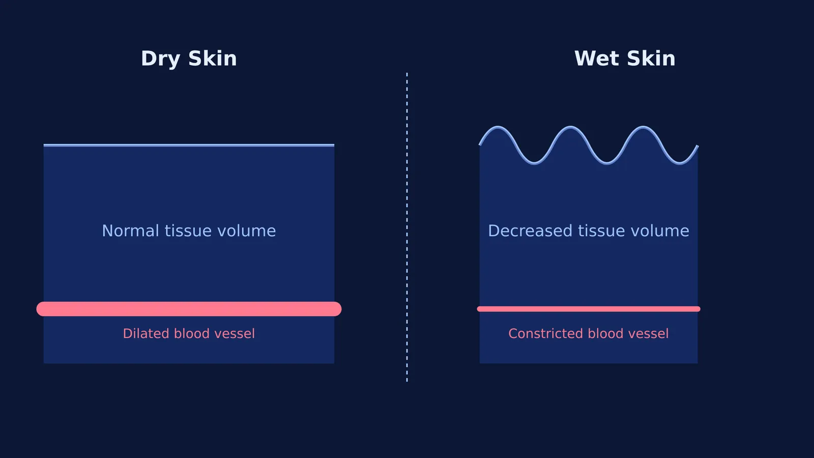 Diagram showing how vasoconstriction shrinks tissue and causes wet skin to buckle