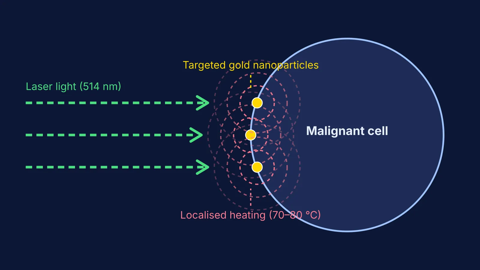 Diagram showing laser light hitting gold nanoparticles on a malignant cell to produce heat