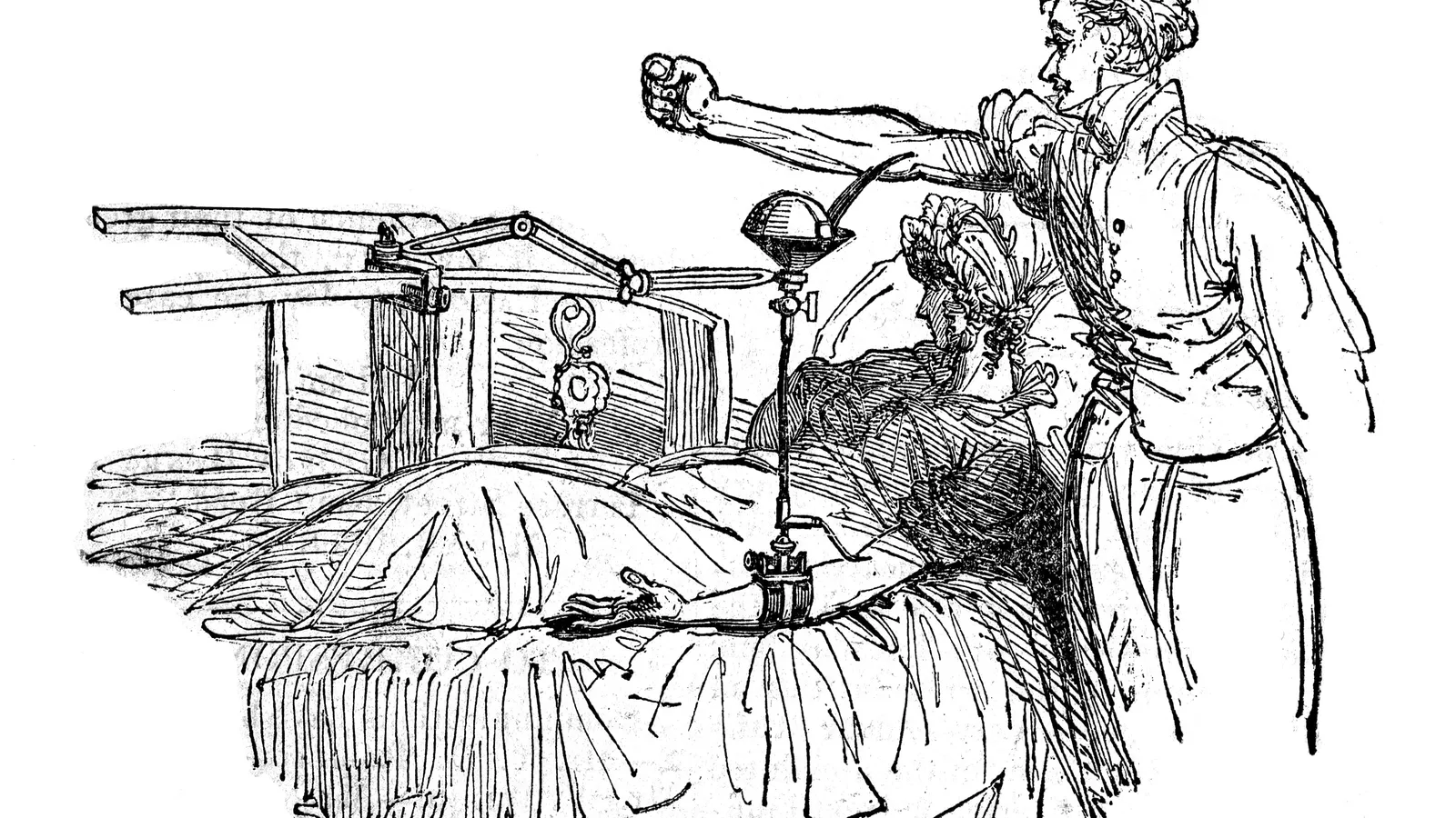 Engraving of Blundell's gravitator: a standing donor's blood runs by tube into a woman's arm